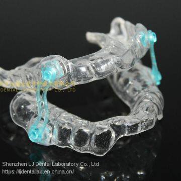 Anti-snoring Device, Dental Sportguard, Occlusal Splint, Laboratoire Dentaire, Dentallabor, Laboratorio Dental, Dental Laboratory, Shenzhen LJ Dental Lab China