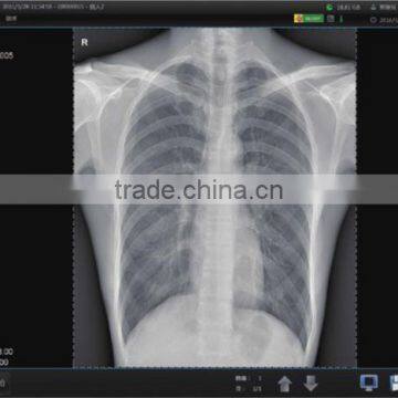 Wired or Wireless High Resolution Flat Panel Detector for Sale photo-3