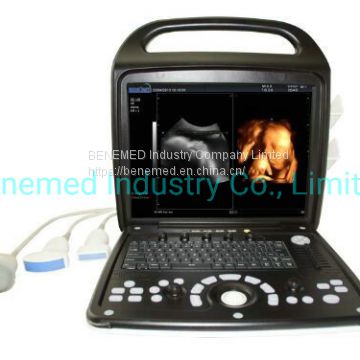 Premium 4D Color Doppler Ultrasound Scanner