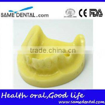 Mandibular Implant Dental Training Model (no gum) Dental Eduction Assitant No. DEA-22