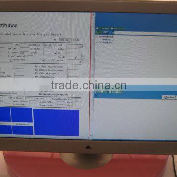 Beautiful Sperm Analysis System Analysis of Sperm Quality photo-5