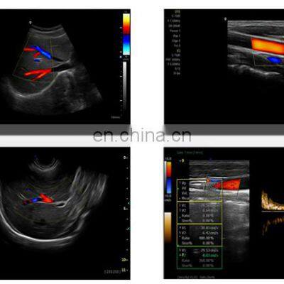 Hot Selling Medical Cheapest-portable-ultrasound-machine for Hospital and Clinic Use photo-5