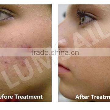 Skin Whitening 2016 New Product Promote Skin Health Led Light For Skin Care Pdt Beauty Machine And Equipment Skin Care Massaging Machine photo-6