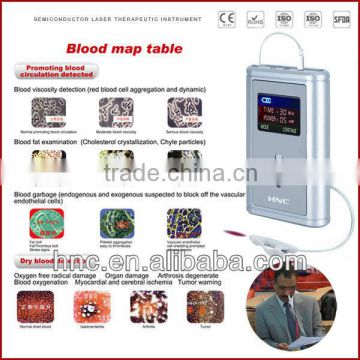 non-drug painless rhinitis blood sugar treatment pulse laser therapy