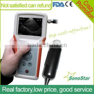 Sonostar advanced mini portable ultrasound machine handheld ultrasound scanner V1