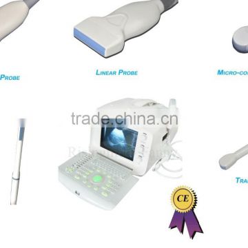 CE approved Portable Ultrasound Scanner with 3.5Mhz multi-frequency convex probe RUS-6000A