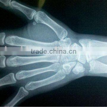 china medical dry film,medical x-ray film, x-ray film digitizer,scrap x-ray film for sale