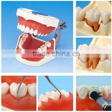 The lowest price Silica gel Gum disease model