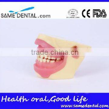 NISSIN Anesthesia Extraction Model School Teaching Demonstration