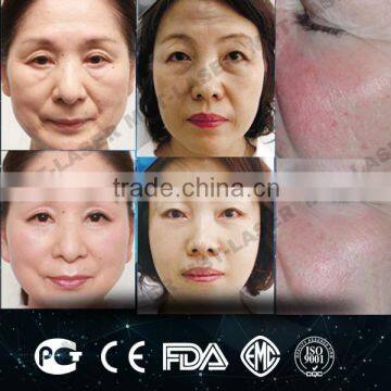 Ultrasound Fat Reduction Machine 4 Different Handle Cavitation Vacuum Cavitation Rf Slimming Multifunction Machine For Wrinkle Removal Non Surgical Ultrasonic Liposuction photo-4