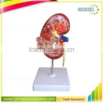 Pathological Medical Human Body Anatomy Model Kidney