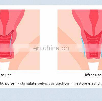 Magnetic Pelvic Floor Chair Magnetic Therapy Chair Medical Grade Tens Muscle Stimulator photo-4