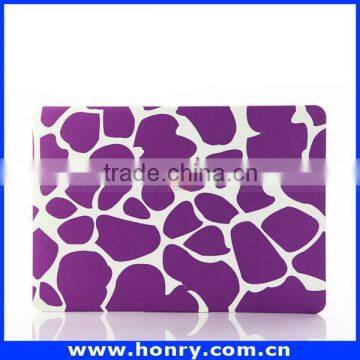 New OEM Special Ultra Thin pc Case for Macbook photo-4
