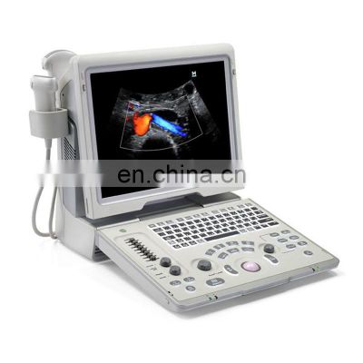 Good scanner Mindray color doppler ultrasound /Mindray z6 /Mindray ultrasound machine