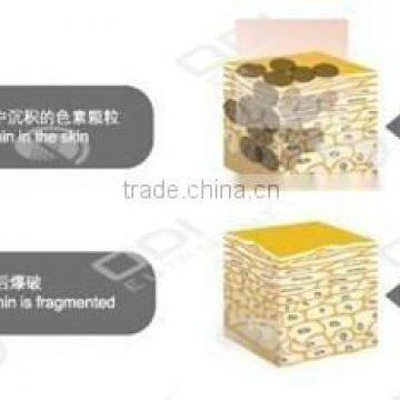 2015 OD-LS450 Multifunction Beauty Machine Tattoo Removal Portable nd Yag q Switch Mini Laser Nevus Removal Machine photo-3