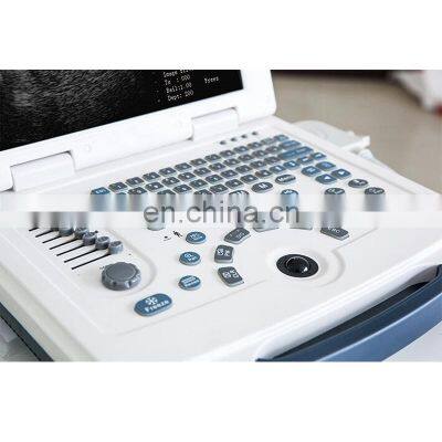 HC-A003VET Animal Portable Price Dog Veterinary Ultrasound Scanner Machine for Cows photo-5