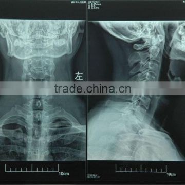 thermal imaging ,medical x-ray film for diagnosis by image made in china