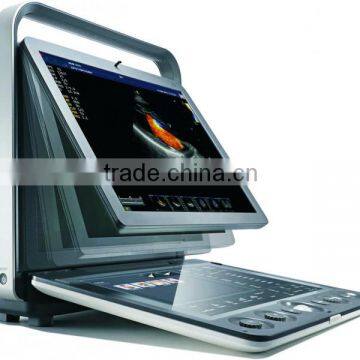 MC-DU-S9 Excellent Superb Portable Color Doppler 3D 4D Ultrasound Machine