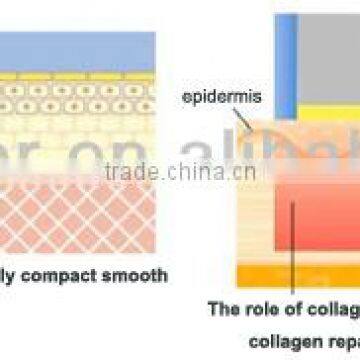 Companies Looking for Distributors in Africa Portable rf Cavitation / Fraction rf photo-2