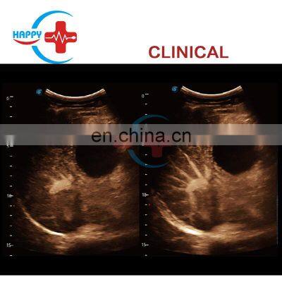 Sonoscape S60 Ultrasound Scanner Color Trolley Medical Ultrasound Machine