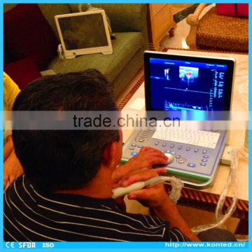 Built-in Report Digital Color Doppler Portable Ultrasound with Better Price