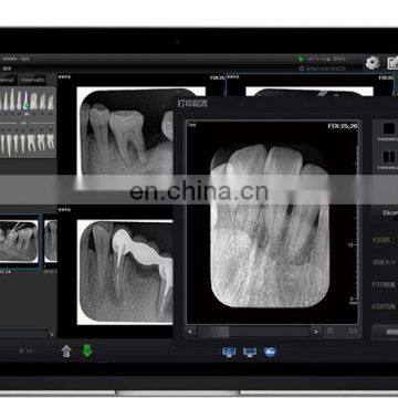 MY-D068-2 Medical Device Rayos x Dental Portatil Portable Intraoral Dental X-ray Film Scanner photo-3