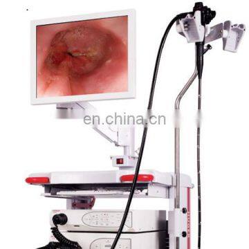 MY-P006B Medical HD Endoscope System With Video Gastroscope and Video Colonoscope photo-2