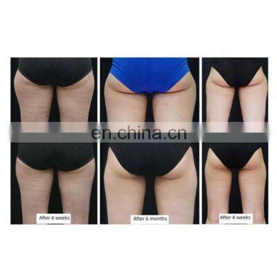 7 Cooling Paddles Body Shaping 360 Surrounding Fat Freezing Machine For Beauty Salon photo-4