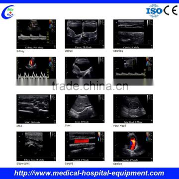 Ultrasound Machines Sale