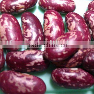 Purple Speckled Kidney Bean( 2010 crop, Heilongjiang Origin, Hps)