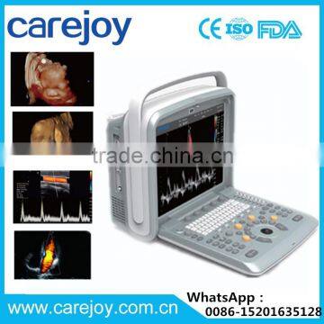 2016 new Portable Color Doppler(Optional 4D) for cardiac use