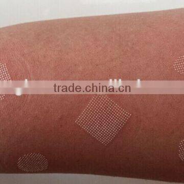 Sanhe Medical CO2 Laser Machine for Stretch Mark Removal With CE photo-6