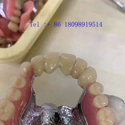 Metal Acrylic Dental Crown China Dental Laboratory photo-3