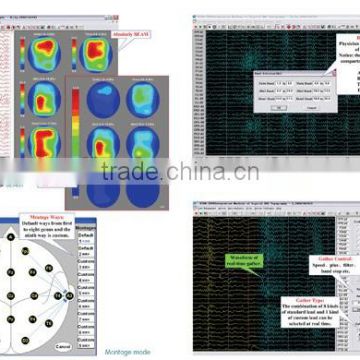 16 Channels multi-channels Digital EEG System for the patient KT88-1018