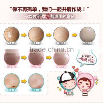 Black Head Remover Face Mask Cleansing Remove Black Head Nose Ex Pore Strip Remover Mask photo-6