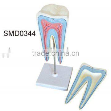 The dissection model of molar