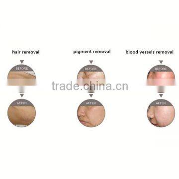 CE Approval Shr Machine/opt Permanent Hair Removal Machine/ipl Shr Laser photo-6