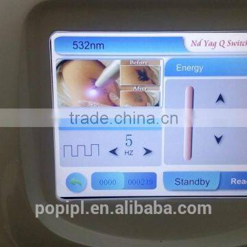 Big Hot All Colors Tattoo Removal 1064 & 532 nd Yag Laser POP-QL6 photo-3