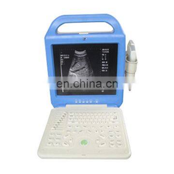 MY-A003A 12 inch monitor black & white laptop portable ultrasound scanner with 2 probe connectors