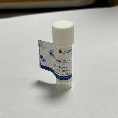 Tris and glutamate dehydrogenase work together on homocysteine assay kit