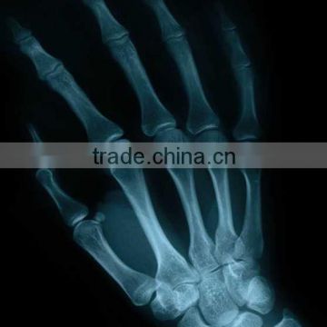 China x ray digital films KND-A/F CE