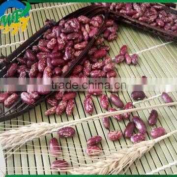 Chinese Purple Speckled Kidney Beans for Sale photo-2