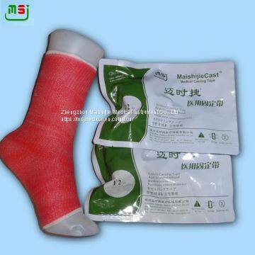 Comfortable and safety Orthopedic Cast for bone fixation