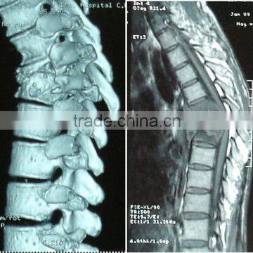 dry digital film,dry medical film,dry x ray film