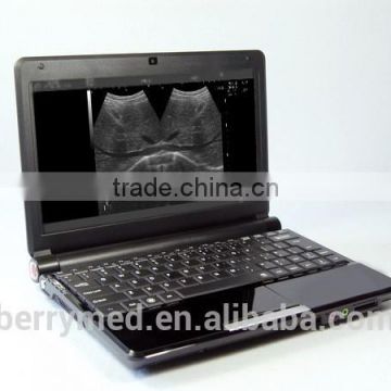 Full Digital Hot Sale B-14 Medical B&W Portable Ultrasound Machine