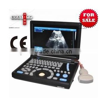 High Quality Cheap Price of Handheld/Notebook/Laptop ultrasound Scanner/machine with convex, linear, vaginal, rectal transducer-