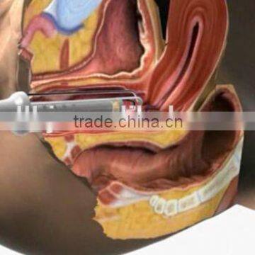 New rf Fractional Laser Co2 / Co2 Fractional Laser / Vaginal Tightening Handpiece photo-5