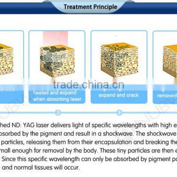 Q Switch Laser Tatoo Removal / nd Yag Laser / Eyebrows / Age Spot Removal photo-6