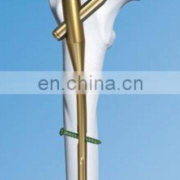 Orthopedic Trauma Implants PFNA photo-2