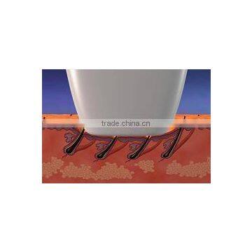 Best Choice Aroma Diode Laser With Fast Hair Removal Technology in Usa photo-5